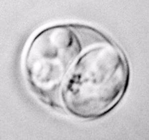 Neopspora is an increasingly common protozoal cause of abortion in cattle