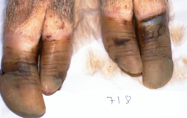 Sow Foot Lameness and Hoof Care