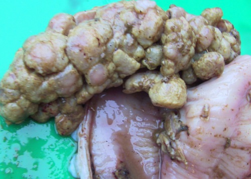 13 Johnes Paratuberculosis wasting diseases sheep intestinal adenocarcinoma