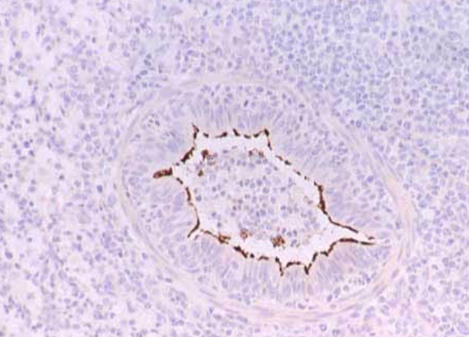 Mycoplasma F4